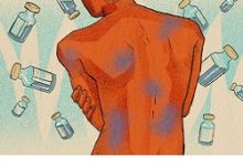 Photo of Побочки после вакцинации