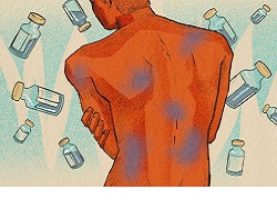 Photo of Побочки после вакцинации